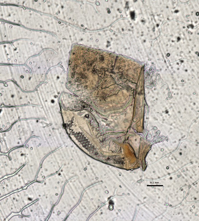 Ephemerythus (Tricomerella) straeleni s1 head mouthparts 8 10x.jpg