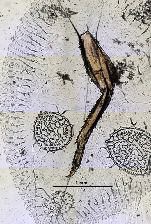 Ephemerythus (Tricomerella) straeleni s4 leg 5 5x.jpg