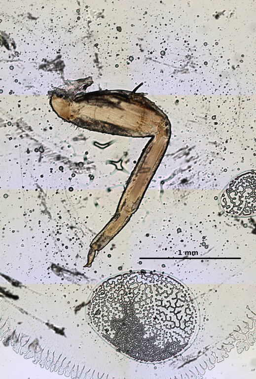 Ephemerythus (Tricomerella) straeleni s4 leg 6 5x.jpg