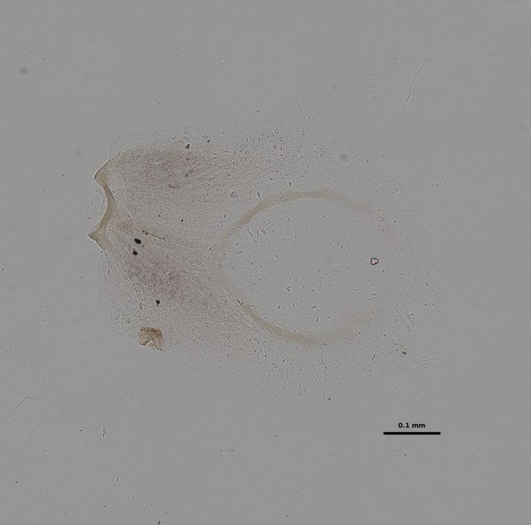 Ephemerythus (Tricomerella) straeleni s5 gill 2 20x.jpg