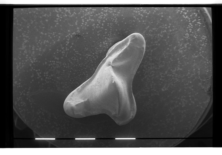 occlusal view