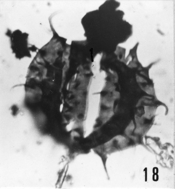 Fig. 18 - Acanthodiacrodium adligans (Timofeev, B., 1959) n. comb. Mas de Mougno : MOU-1. b 462.