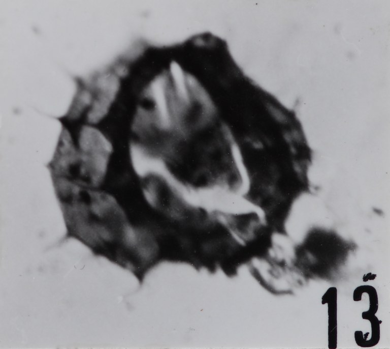 Fig. 13 - Acanthodiacrodium adligans (Timofeev, B., 1959) n. comb. Roque de Bandies : RDB-1. b 428