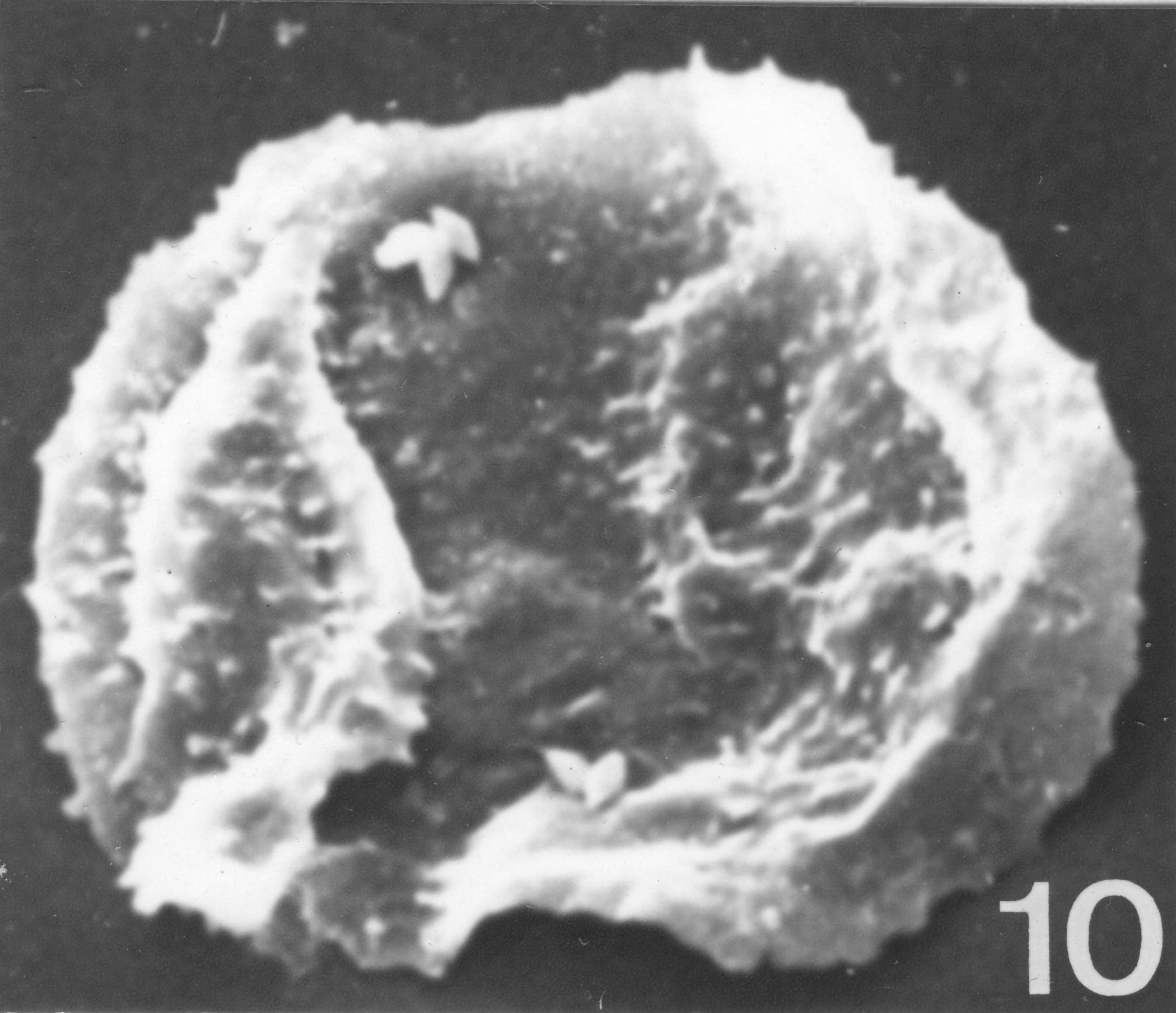 Fig. 10 - Acanthodiacrodium angustum (Downie, C., 1958) Combaz, A., 1967. CHE-31. I. R. Se. N. B. N° b530.