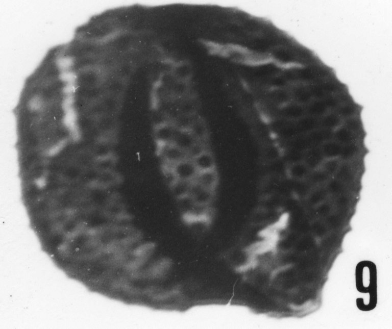 Fig. 9 - Acanthodiacrodium angustum (Downie, C., 1958) Combaz, A., 1967. Roque de Bandies : RDB-1. b 429.