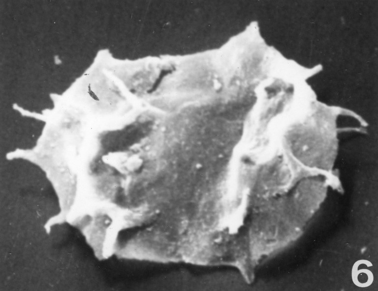 Fig. 6 - Acanthodiacrodium complanatum (Deunff, J., 1961) n. comb. CHE-18. I. R. Se. N. B. No b538.