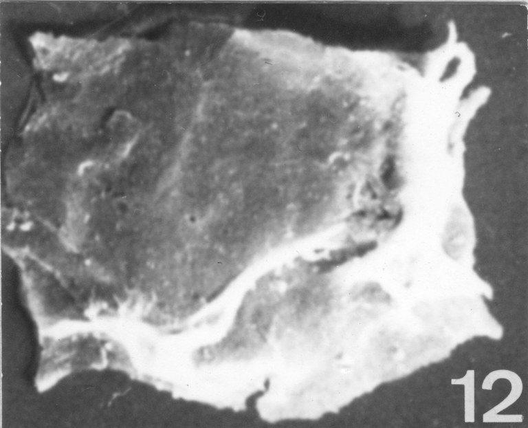 Fig. 12 - Acanthodiacrodium complanatum (Deunff, J., 1961) n. comb. CHE-18. I. R. Sc. N. B. N° b535. 