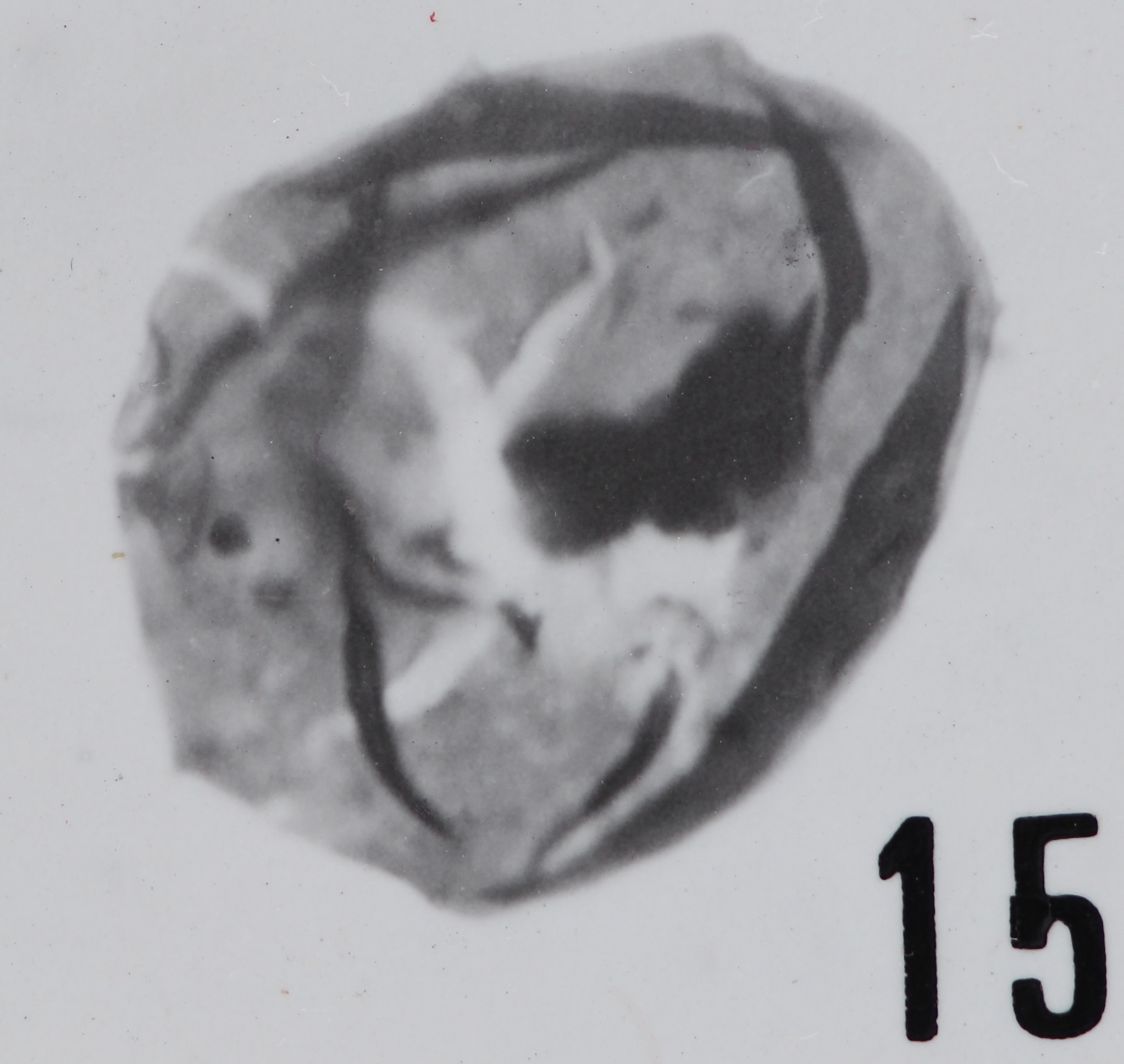 Fig. 15 - Acanthodiacrodium hamatum (Downie, C., 1958) n. comb. Roque de Bandies : RDB-1. b 428.