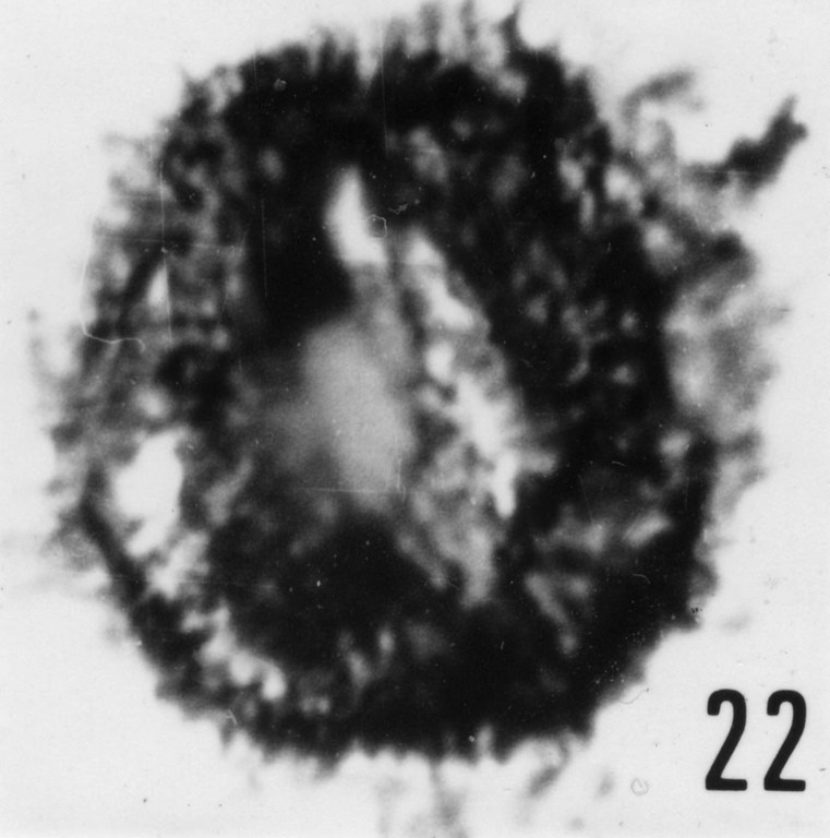 Fig. 22 - Acanthodiacrodium ? lanatum (Timofeev, B. V., 1959) n. comb. Spécimen comprimé latéralement. CHE-20. I. R. Se. N. B. N° b496.