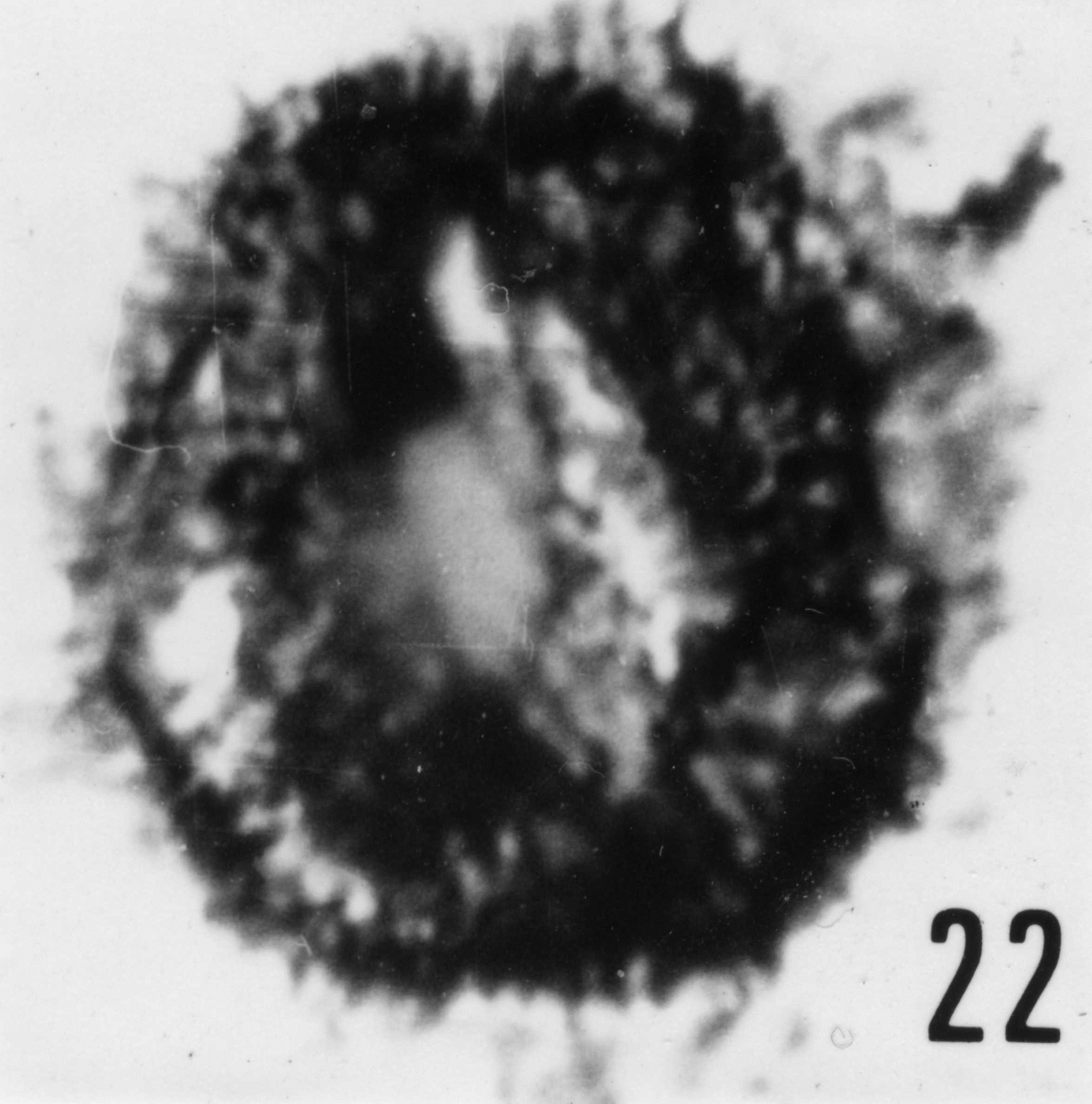 Fig. 22 - Acanthodiacrodium ? lanatum (Timofeev, B. V., 1959) n. comb. Spécimen comprimé latéralement. CHE-20. I. R. Se. N. B. N° b496.