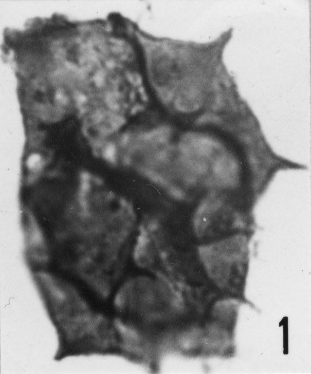 Fig. 1 - Acanthodiacrodium micronatum Timofeev, B. V., 1959. THY-1. I. R. Sc. N. B. N° b488. 