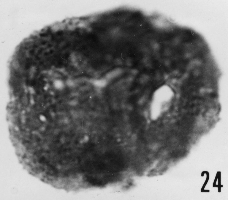 Fig. 24 - Acanthodiacrodium papillare Timofeev, B. V., 1959. THY-1. I. R. Se. N. B. N° b488.