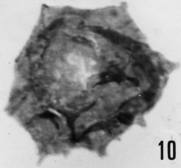 Fig. 10 - Acanthodiacrodium partiale Timofeev, B. V., 1959. THY-1. I. R. Sc. N. B. No b488. 