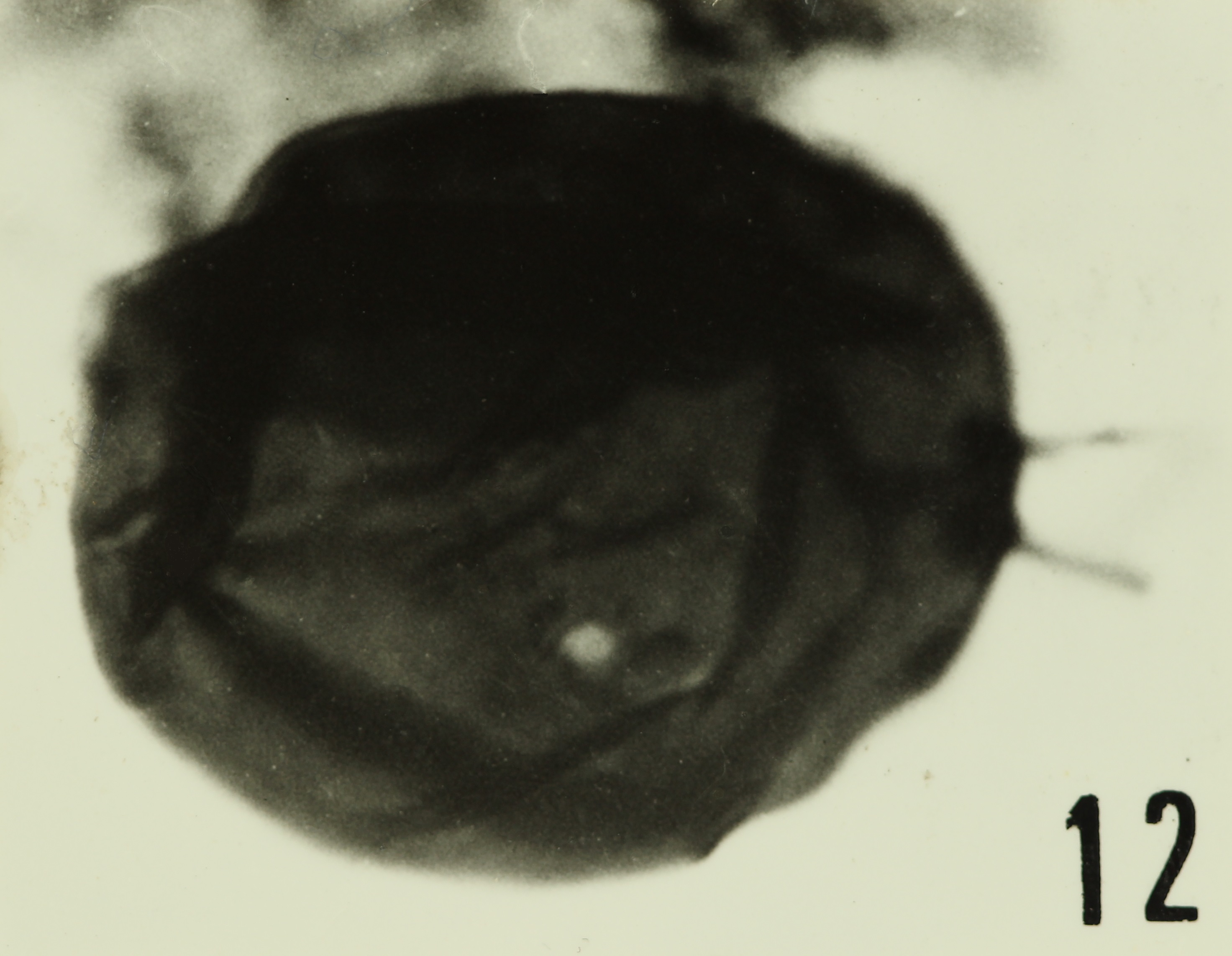 Fig. 12 - Acanthodiacrodium simplex Combaz, A., 1967. La Roquemaillère : ROQ-17. b 453.