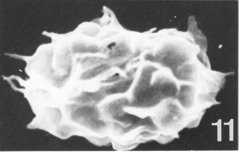 Fig. 11 - Acanthodiacrodium tuberatum (Downie C., 1958) Martin, F., 1972. I. R. Se. N. B. No b536. 