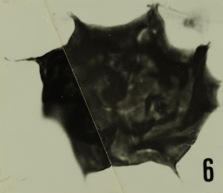 Fig. 6 - Acanthodiacrodium tuberatum (Downie, C., 1958), n. comb. Mas de Mougno : MOU-1. b 466. 