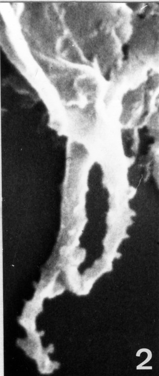 Fig. 2 - Acanthodiacrodium ubui Martin, F., 1969. Détail d'appendices. CHE-31. I. R. Se. N. B. No b531.