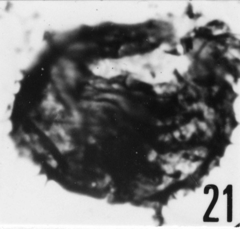 Fig. 21 - Acanthodiacrodium ubui Martin, F., 1969. Ouverture longitudinale. CHE-31. I. R. Se. N. B. N° b510.