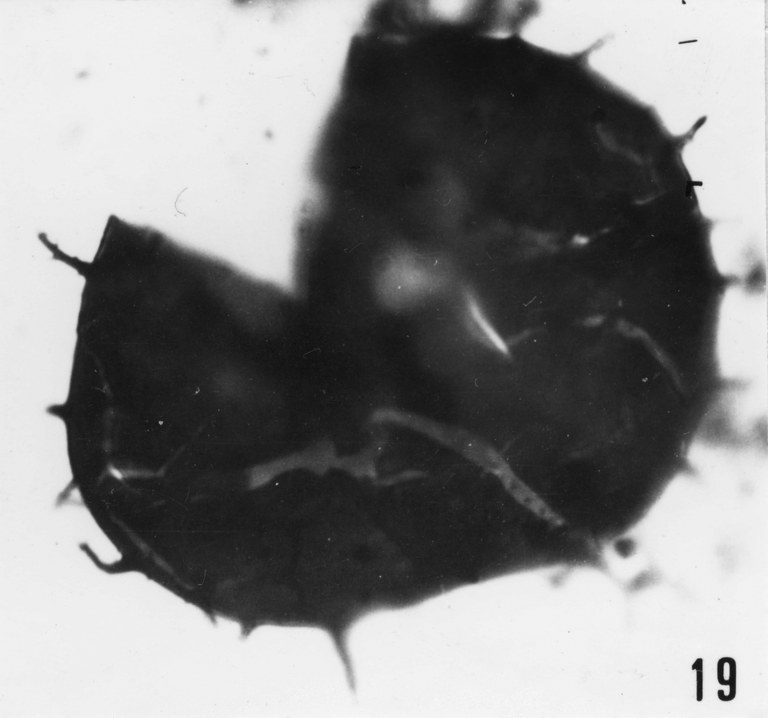 Fig. 19 - Acanthodiacrodium aff. ubui Martin, F., 1969. La Roquemaillère : ROQ-19. b 457.