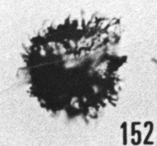 Fig. 152 - Baltisphaeridium cf. multipilosum (Eisenack). —154,50 m. b 365.
