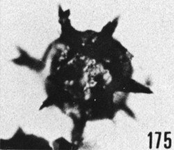 Fig. 175 - Baltisphaeridium ? sanpetrensis (Cramer). —154,50 m. b 362.