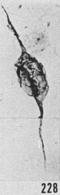 Fig. 228 - Leiofusa tumida Downie. —180,00 m. b 339.