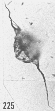 Fig. 225 - Leiofusa tumida Downie. —180,00 m. b 342.