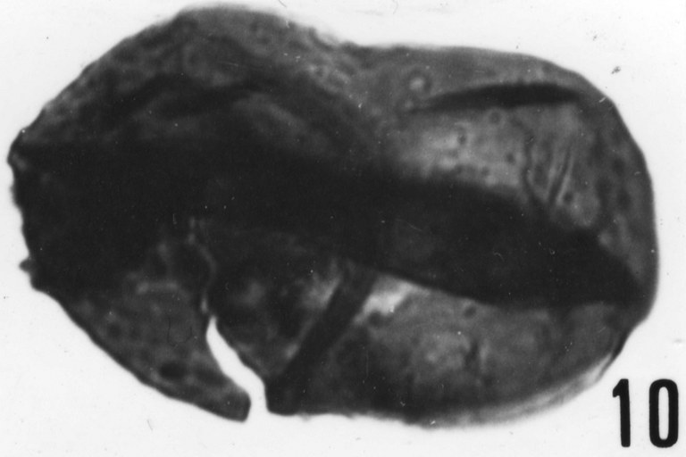 Fig. 10 - Lophodiacrodium filiforme (Timofeev, B., 1959) Deflandre G. et Deflandre-Rigaud, M., 1962. La Roquemaillère : ROQ-4. b 440.