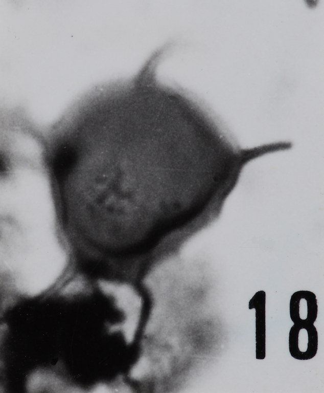 Fig. 18 - Cf. Micrhystridium cleae n. sp. La Roquemaillère : ROQ-17. b 453.