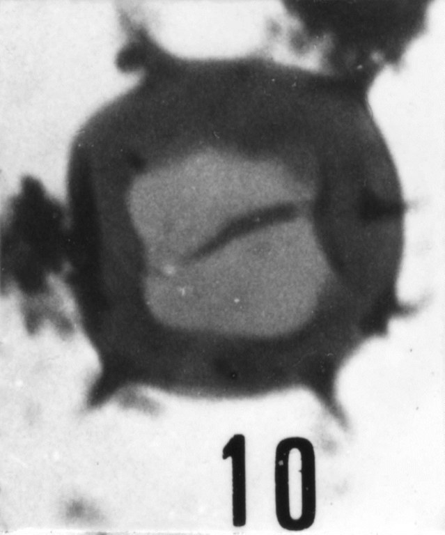 Fig. 10 - Micrhystridium cleae n. sp. La Roquemaillère : ROQ-19. b 454.