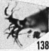 Fig. 138 - Multiplicisphaeridium aff. corallinum (Eisenack); détail d'un appendice. — 154,50 m. b 365.