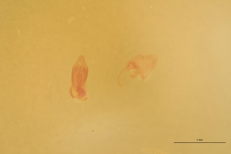Cardiophorus abyssinus M T Aedeagus.jpg Cardiophorus abyssinus M T Aedeagus.jpg