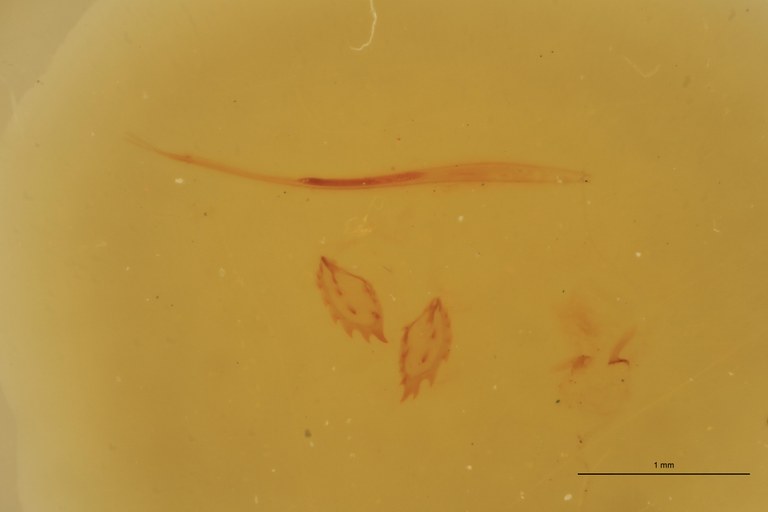 Cardiophorus amari T Microscopic Preparation.jpg Cardiophorus amari T Microscopic Preparation.jpg