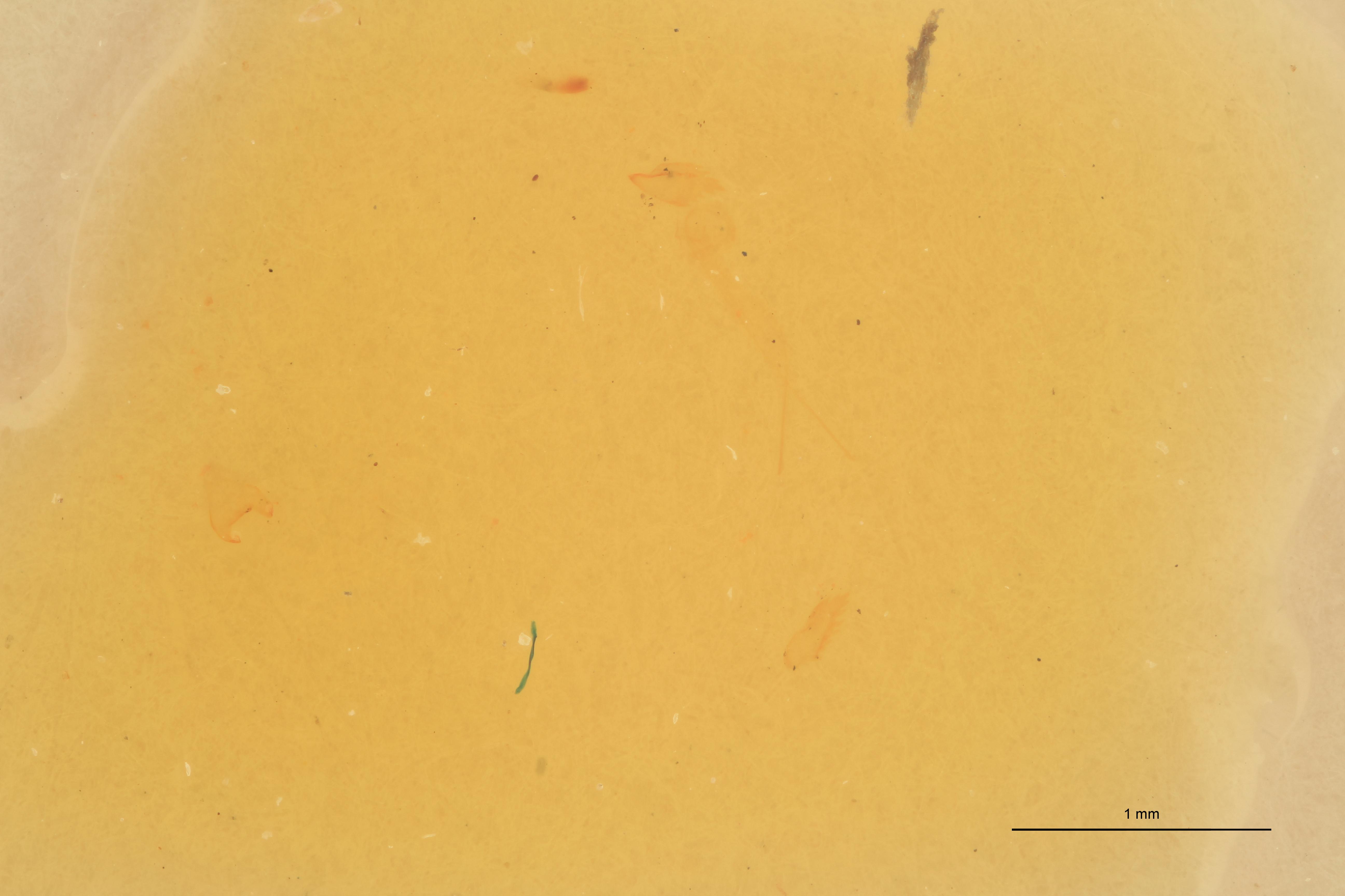 Cardiophorus bradshawi T Microscopic Preparation.jpg