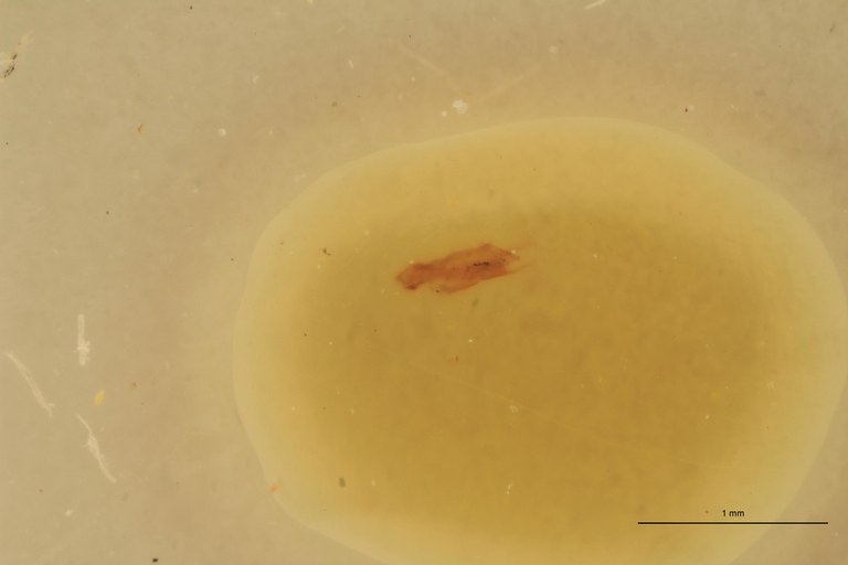 Cardiophorus liberatus M T Aedeagus.jpg Cardiophorus liberatus M T Aedeagus.jpg