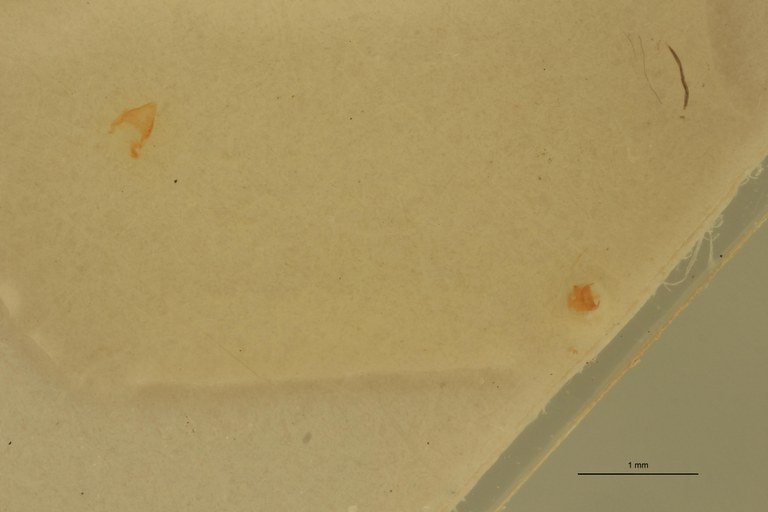 Cardiophorus segnis Lt M Aedeagus.jpg Cardiophorus segnis Lt M Aedeagus.jpg
