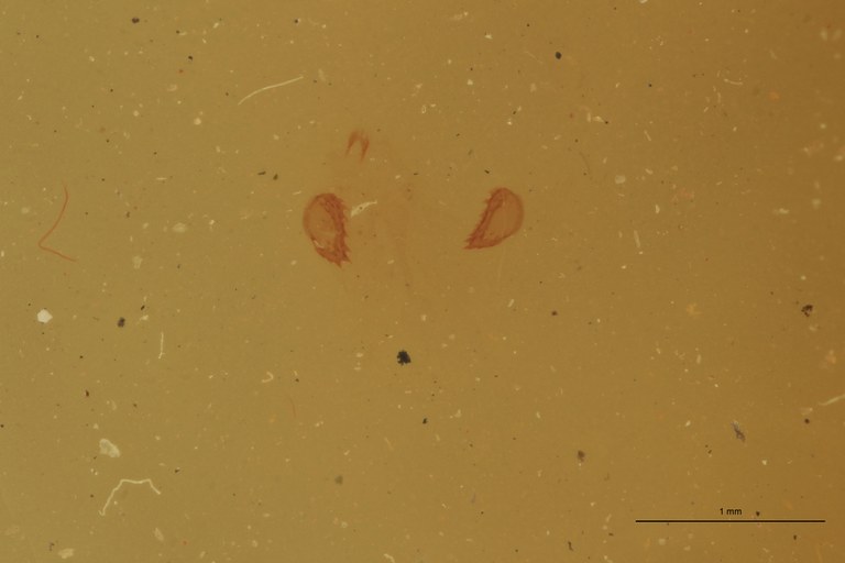 Cardiophorus tingitanus F T Microscopic Preparation.jpg Cardiophorus tingitanus F T Microscopic Preparation.jpg