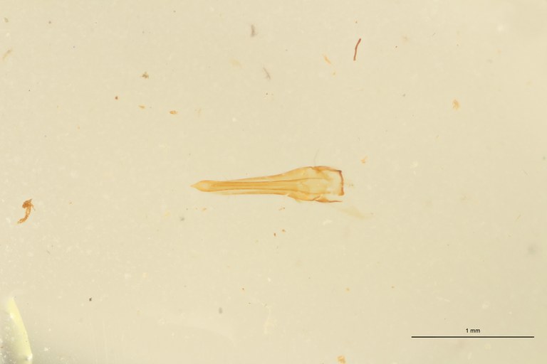 Xanthopenthes cambodianus M Ht Aedeagus.jpg Xanthopenthes cambodianus M Ht Aedeagus.jpg