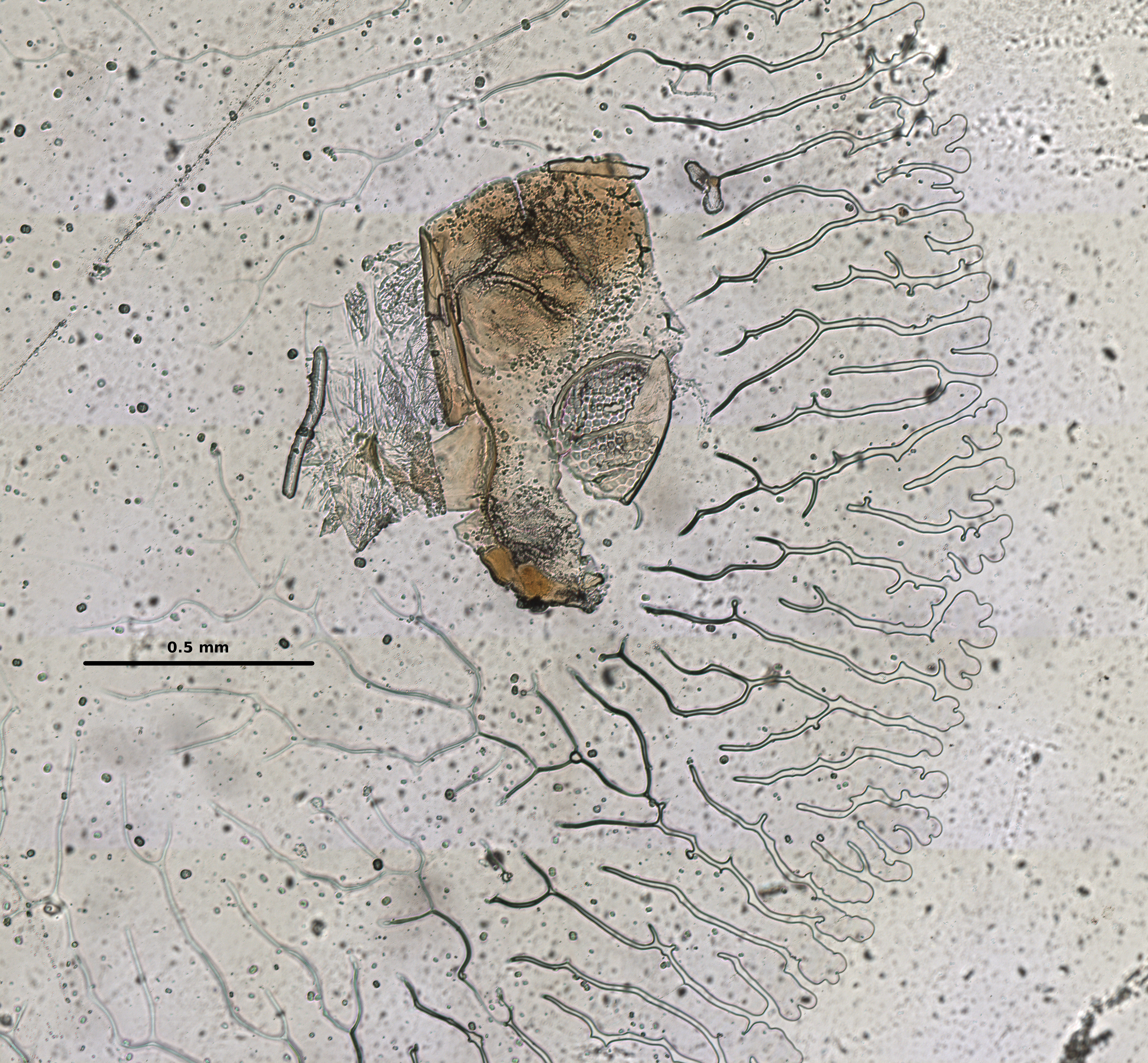 Ephemerythus (Tricomerella) straeleni s1 head mouthparts 1 10x.jpg