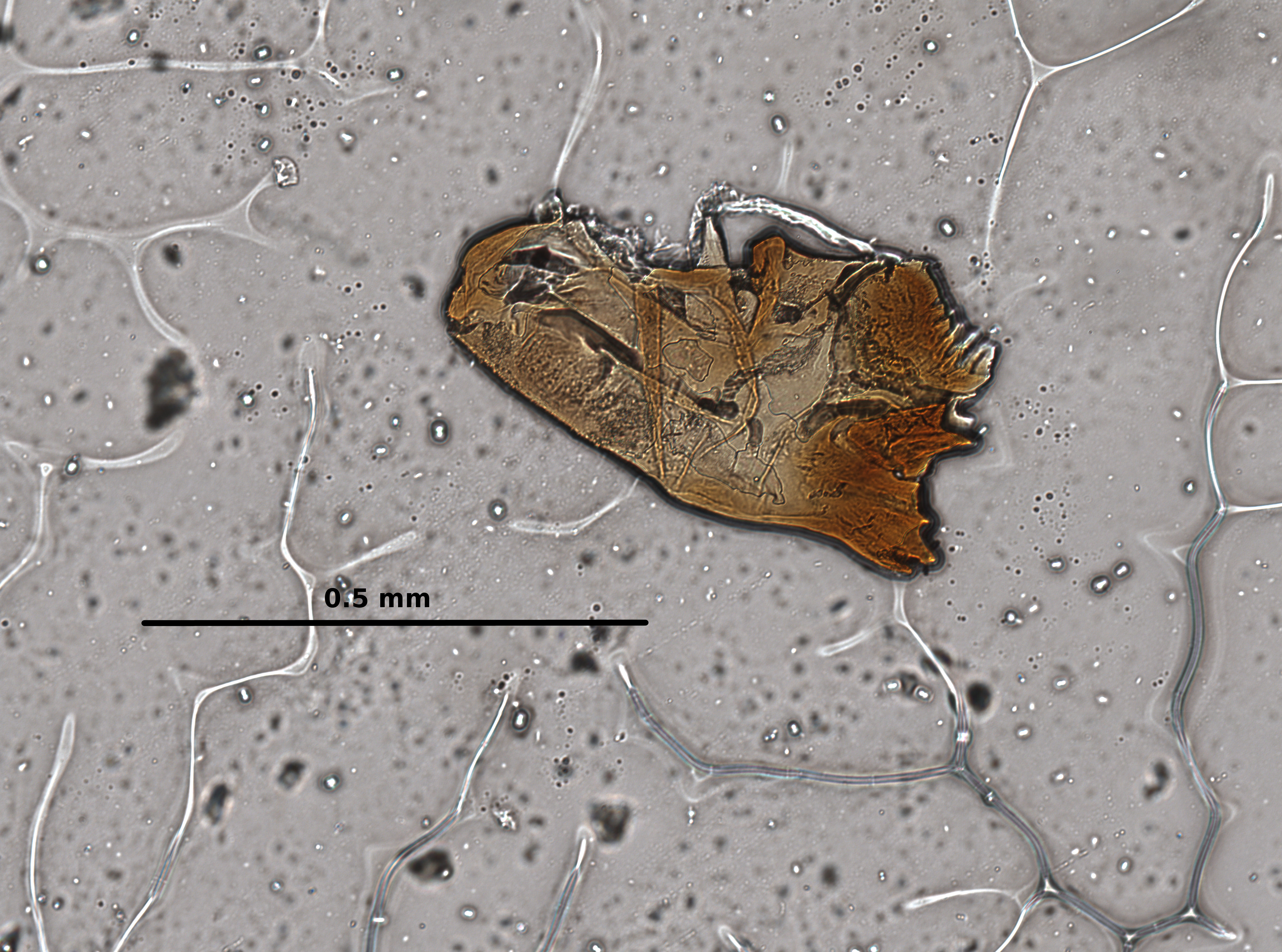 Ephemerythus (Tricomerella) straeleni s1 head mouthparts 2 20x.jpg