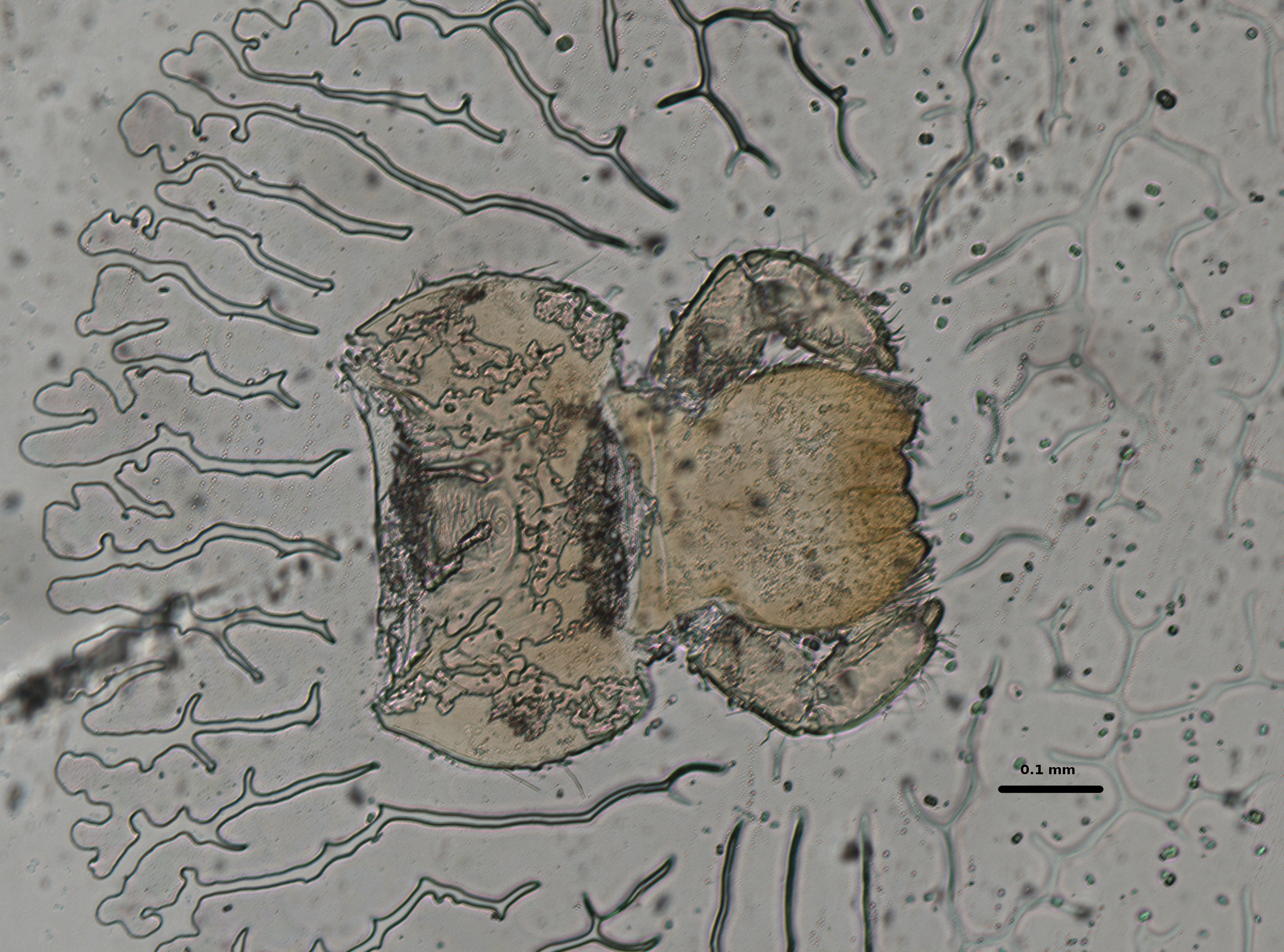 Ephemerythus (Tricomerella) straeleni s1 head mouthparts 4 10x.jpg