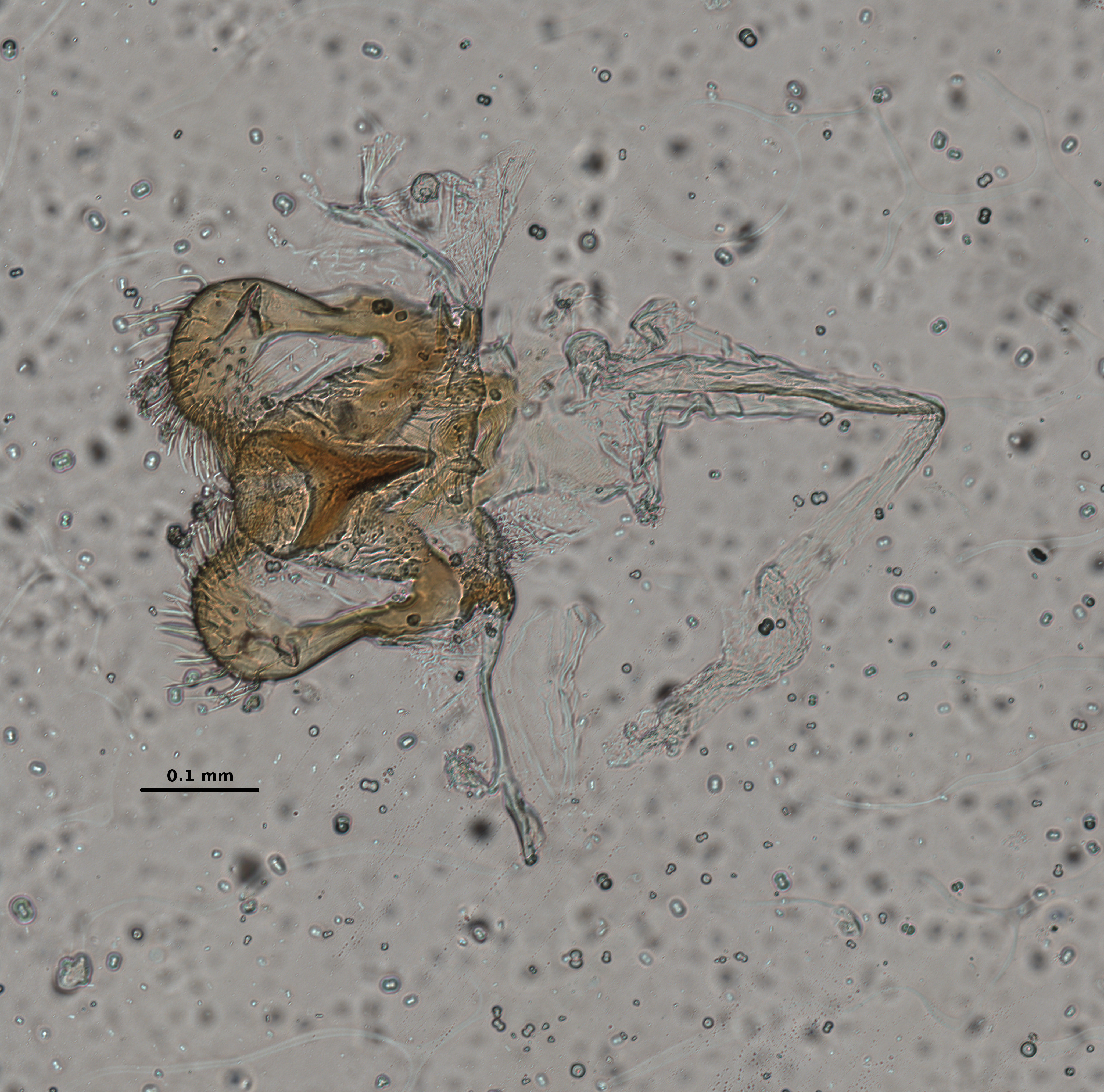 Ephemerythus (Tricomerella) straeleni s1 head mouthparts 5 20x.jpg