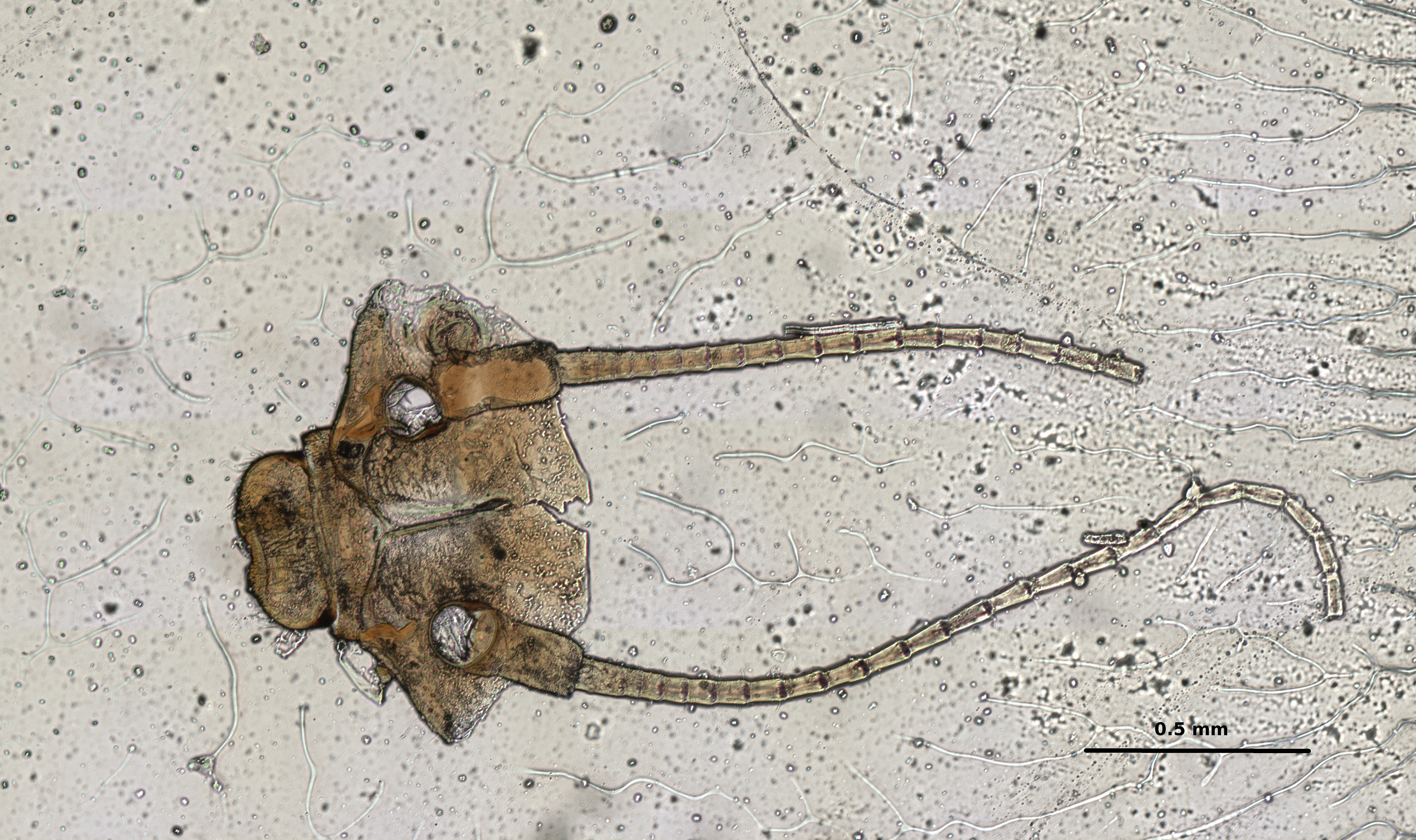 Ephemerythus (Tricomerella) straeleni s1 head mouthparts 9 10x.jpg