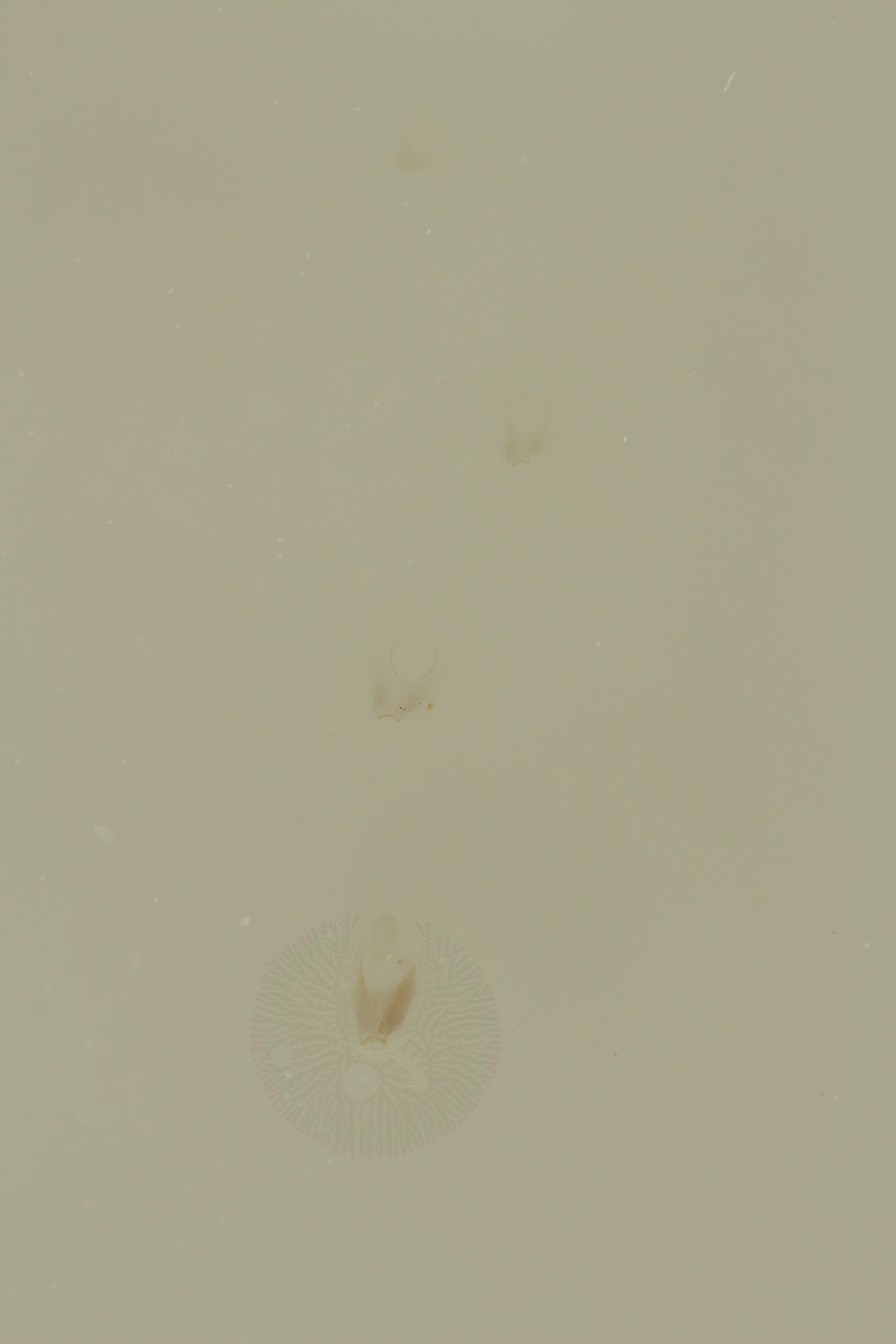 Ephemerythus (Tricomerella) straeleni s5 ht.JPG
