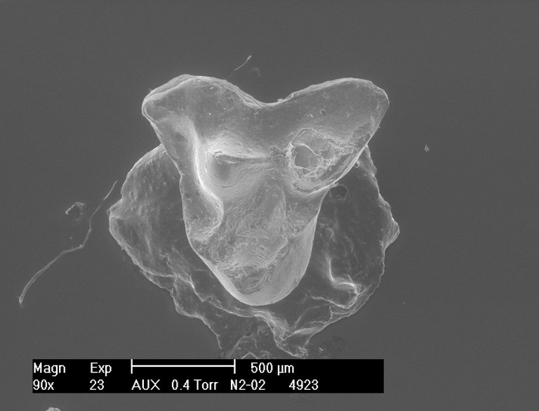 M1975 occlusal