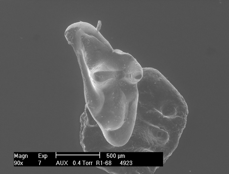 M1984 occlusal