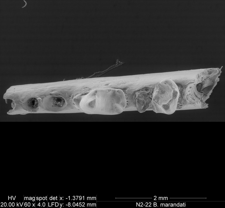 M1991 occlusal