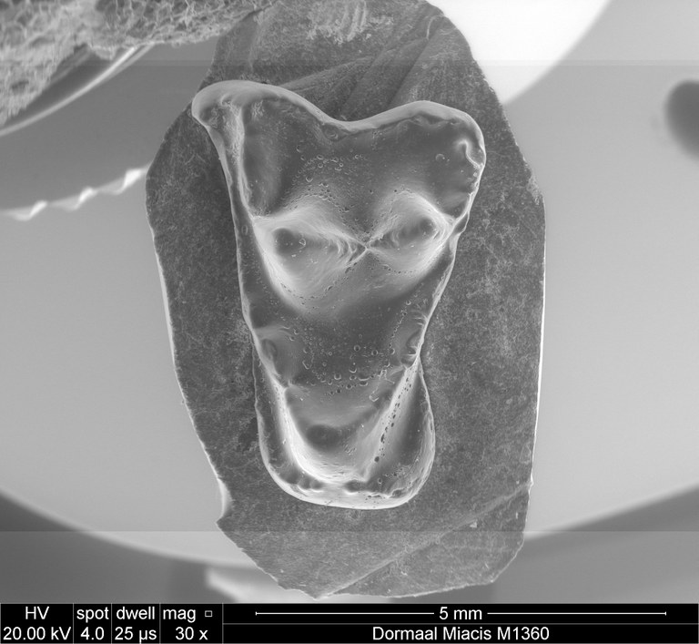 occlusal view