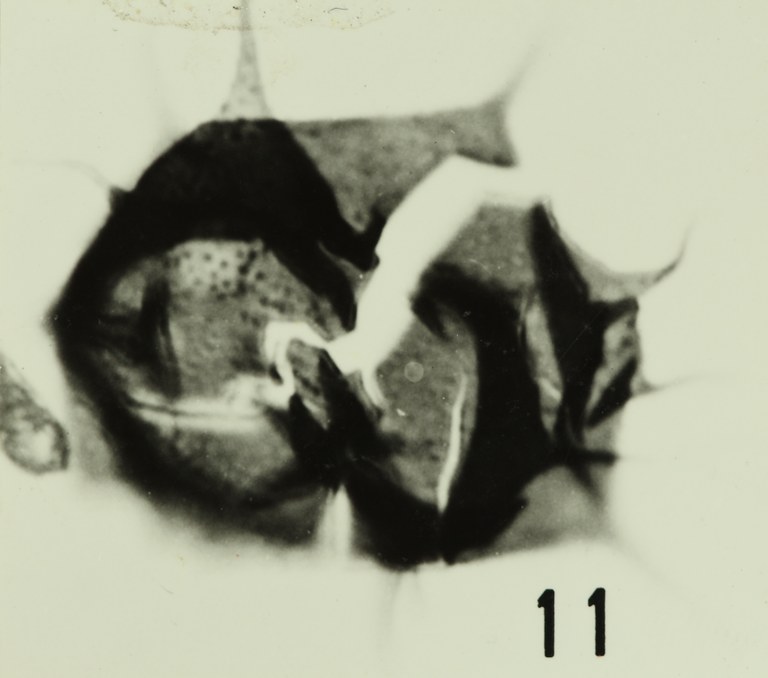 Fig. 11 - Acanthodiacrodium achrasi n. sp. La Roquemaillère : ROQ-6. b 451. 