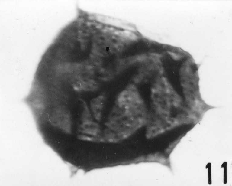 Fig. 11 - Acanthodiacrodium achrasi n. sp. La Roquemaillère : ROQ-6. b 444. X 1.000
